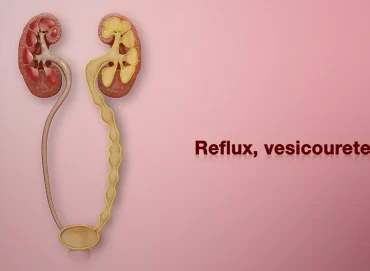 Çocuklarda böbrek reflüsü (VUR) ve tedavi seçenekleri