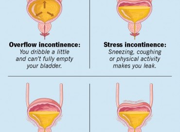 Ürolojik problemlerde stres ve yaşam tarzının etkisi