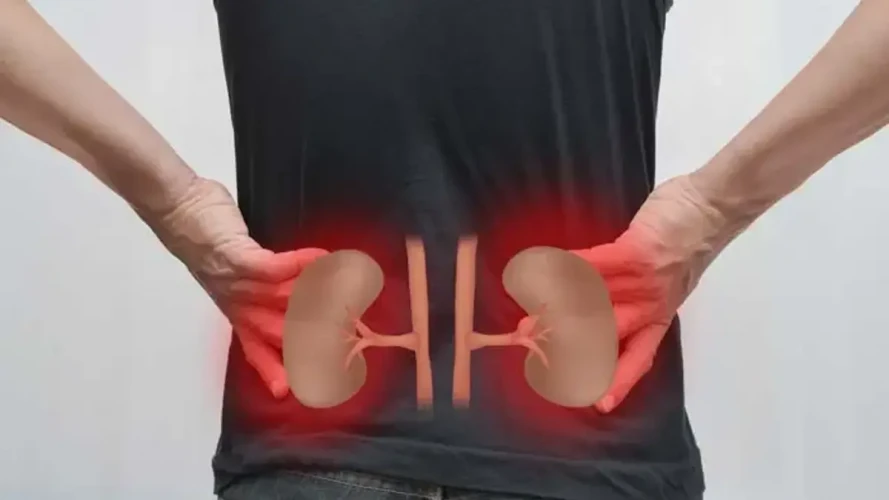 Böbrek Ağrısı: Nedir, Neden Olur, Belirtileri ve Ayırıcı Tanı