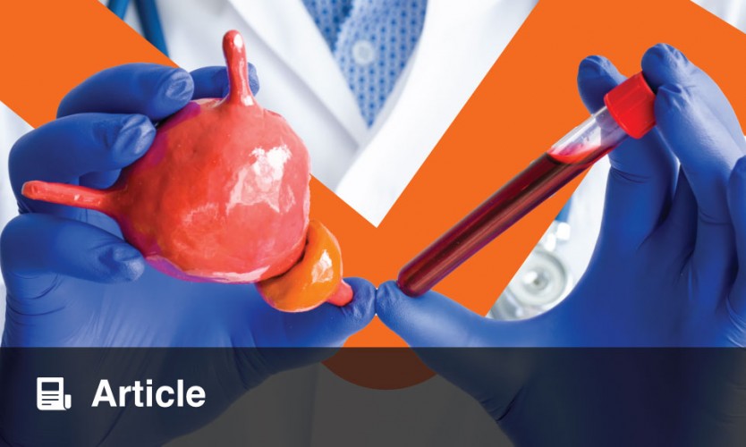 Prostat Muayenesi Ankara Nasıl Yapılır?