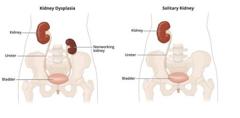 Böbrek sağlığını korumak için günlük hayatta yapılabilecekler