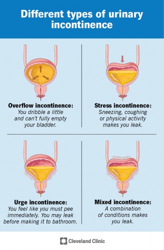 Ürolojik problemlerde stres ve yaşam tarzının etkisi